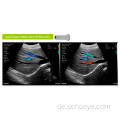 Entstehung mit tragbarem Ultraschall